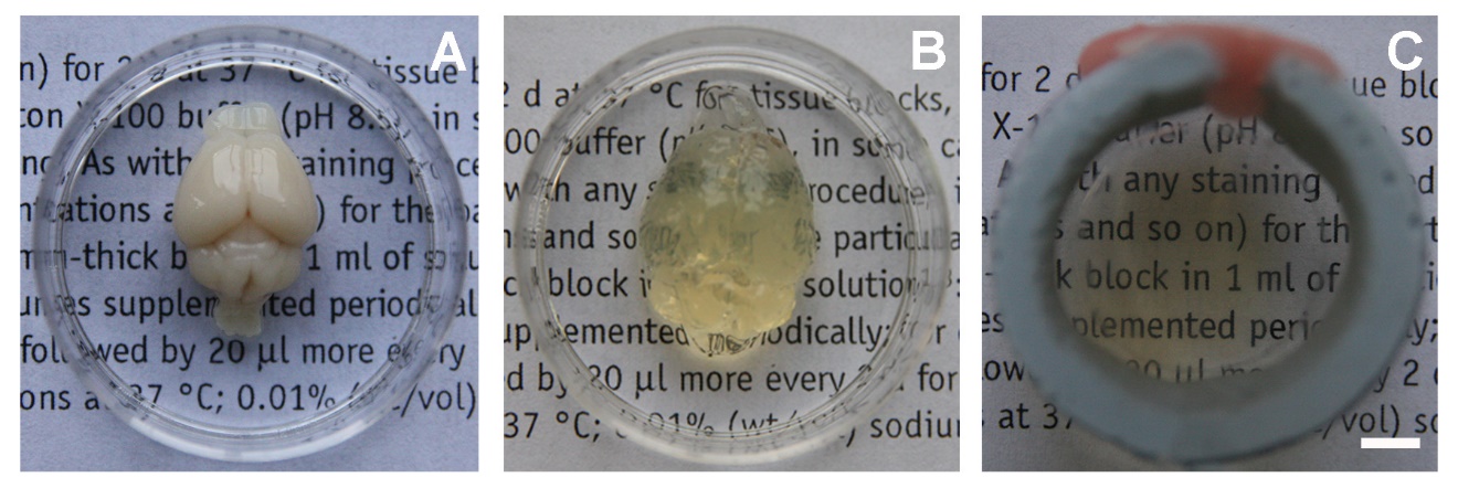 CLARITY for High-resolution Imaging and Quantification of Vasculature in  the Whole Mouse Brain