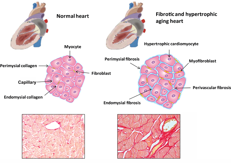 Aging and Cardiac Fibrosis