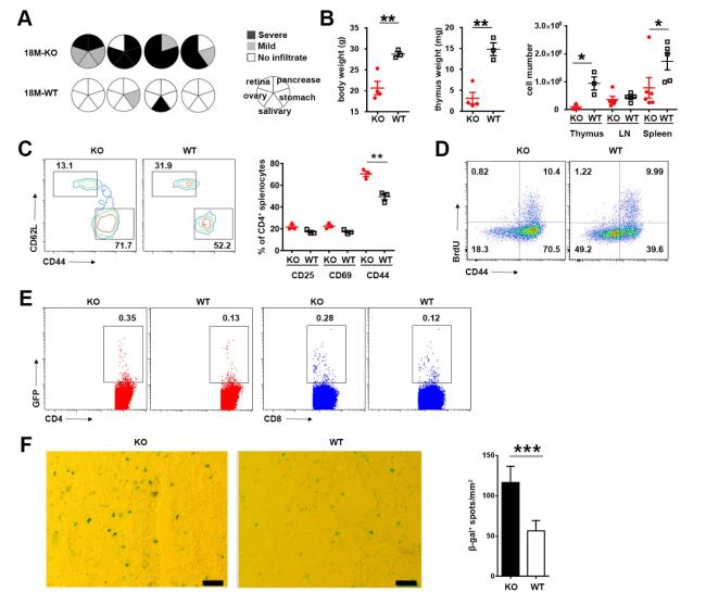 Th1 Biased Progressive Autoimmunity in Aged Aire-Deficient