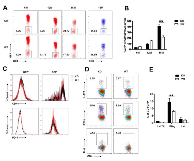 Th1 Biased Progressive Autoimmunity in Aged Aire-Deficient