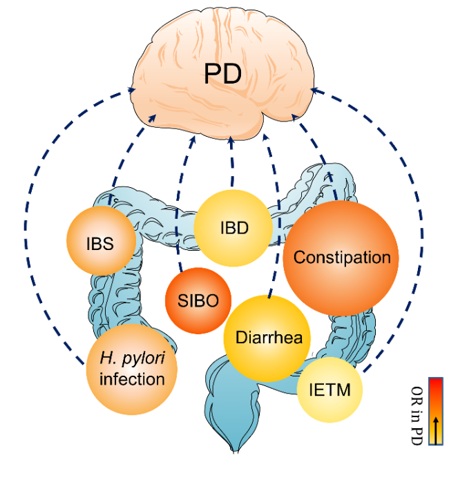 amu専用ページ Intestinal Inflammation and Parkinson's Disease