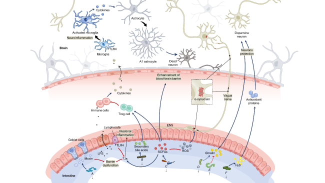 JJ様 Intestinal Inflammation and Parkinson's Disease
