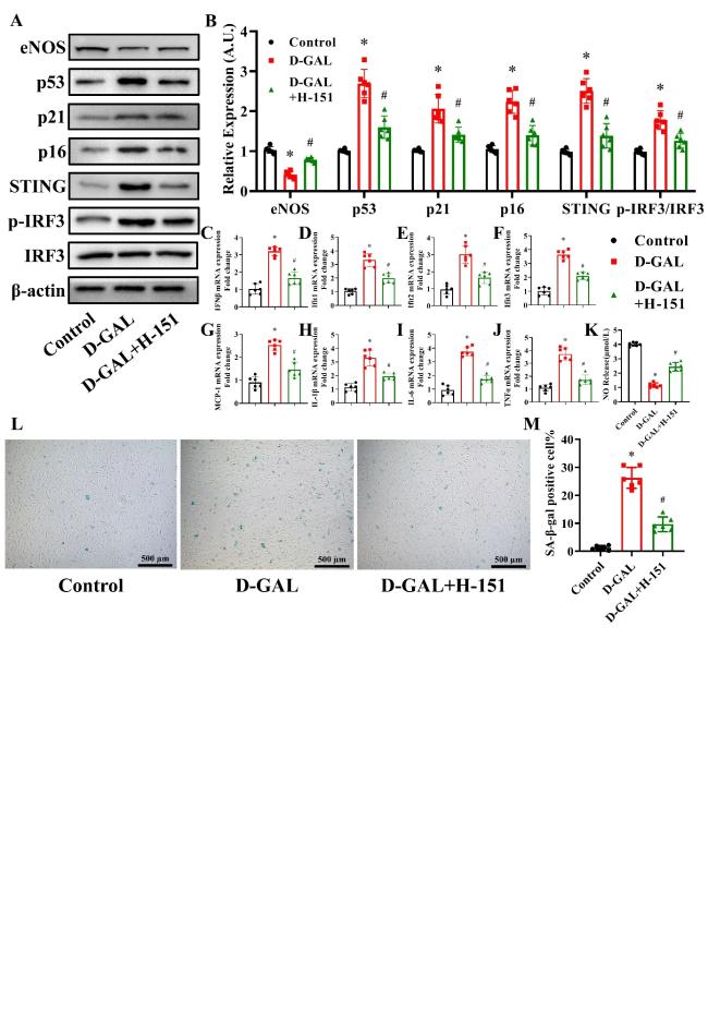 Role of the cGAS-STING Pathway in Aging-related Endothelial