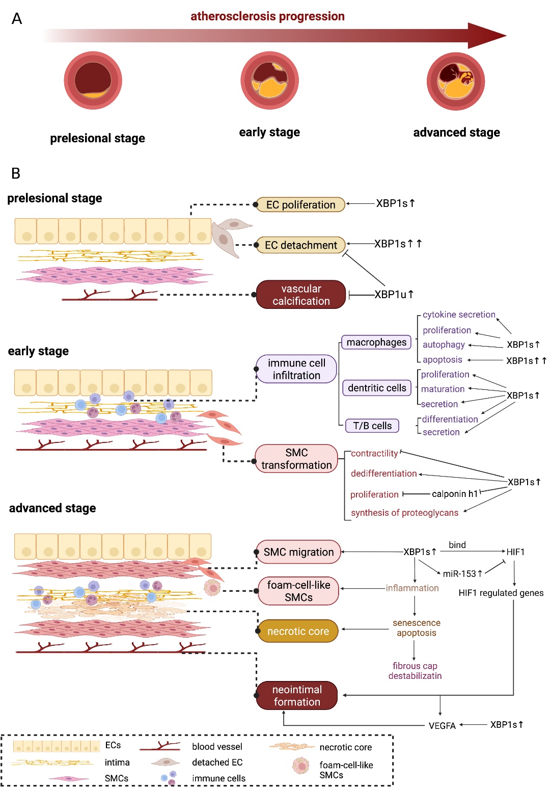 X-box Binding Protein 1: An Adaptor in the Pathogenesis of X-box Binding Protein 1: An Adaptor in the Pathogenesis of