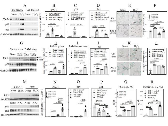 Plasminogen Activator Inhibitor-1 Is a Marker and a Mediator of