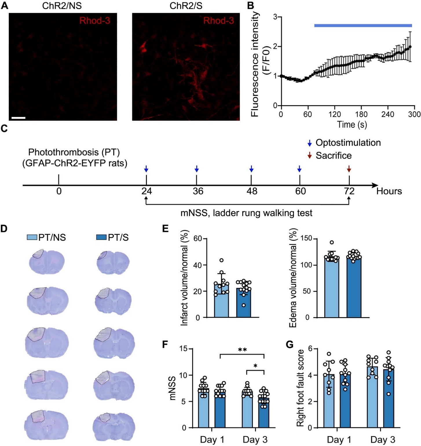 Stroke subtype-dependent synapse elimination by reactive gliosis in mice