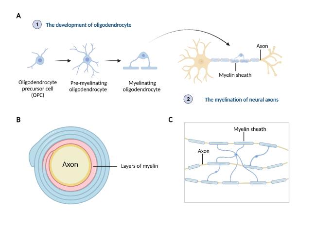 Myelin Pathology in Alzheimer's Disease: Potential Therapeutic Opportunities