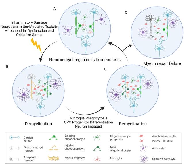 glutathione myelin sheath repair What is Myelin? | Myelin Recovery in Multiple Sclerosis: