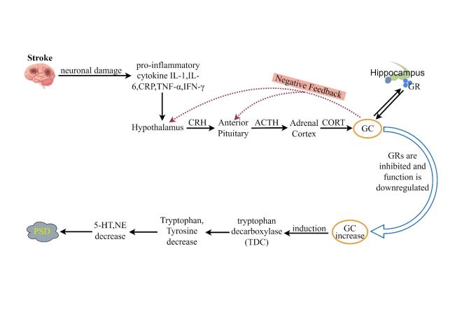 Inflammatory Pathogenesis of Post-stroke Depression