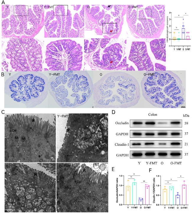 Fecal Microbiota Transplantation Attenuates Frailty via Gut-Muscle
