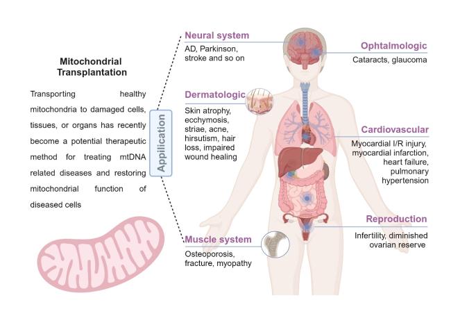 Engineered Mitochondrial Transplantation as An Anti-Aging
