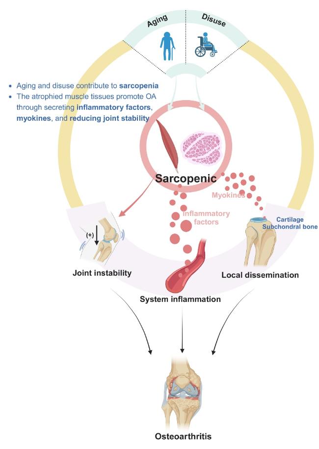 The Organ-Joint Axes in Osteoarthritis: Significant