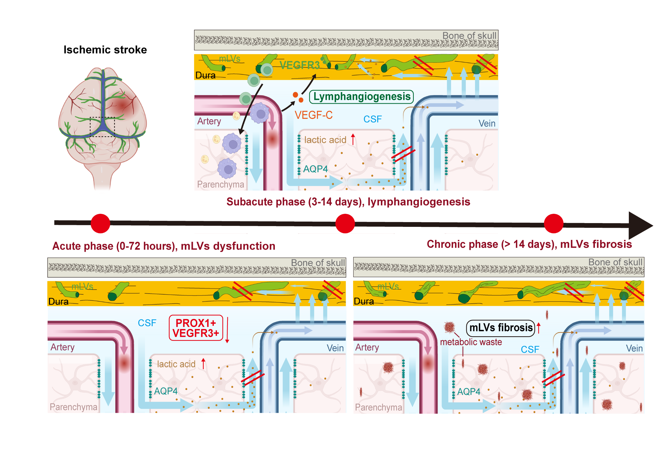 Targeting Meningeal Lymphatic Vessels to Advance Stroke Therapy