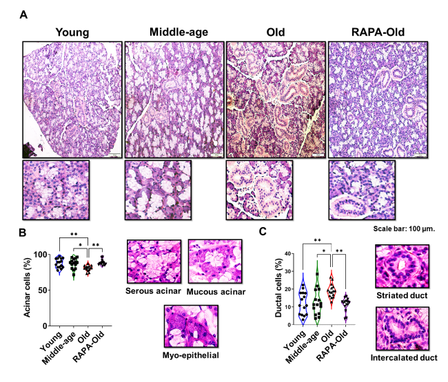 Rapamycin Attenuates Age-Related Changes in Marmoset Submandibular Gland: A Non-Human Primate Model of Human Oral Aging