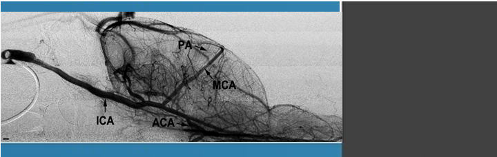 The Role of Bone Marrow Microenvironment in Governing the